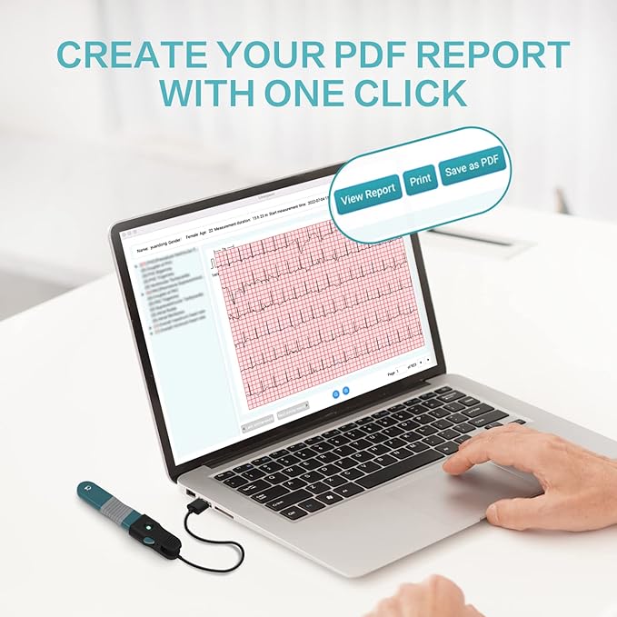 The Top ECG EKG Monitors for Home Use in 2024! 13 Ai HR 2