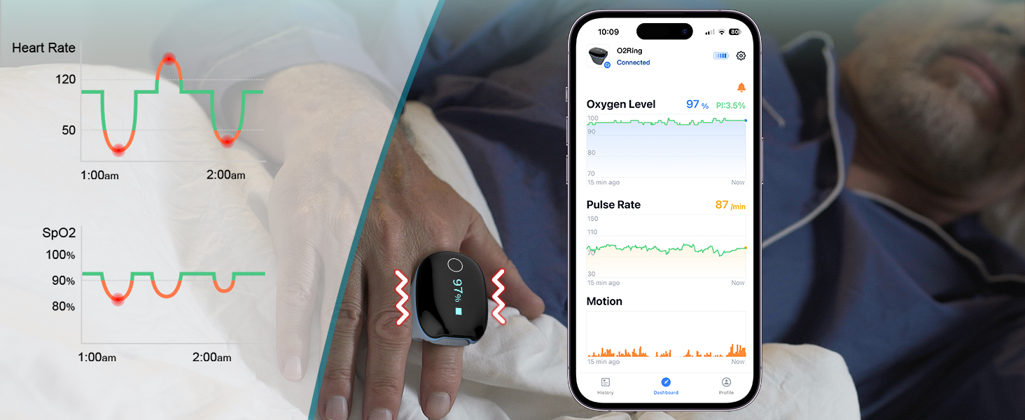 Top Smart Rings of 2025: Best for Fitness, Sleep Tracking & Beyond! 6 o2Ring